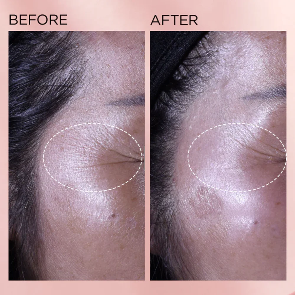 Elizabeth Arden Retinol + HPR Rapid Skin Renewing Ceramide Serum 30 Capsules - Image 5