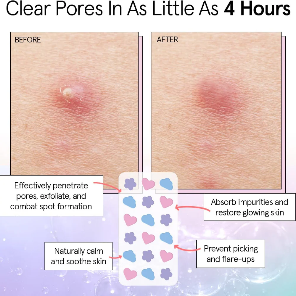 Grace & Stella Hydrocolloid Pimple Patches Multishape x72 - Image 3