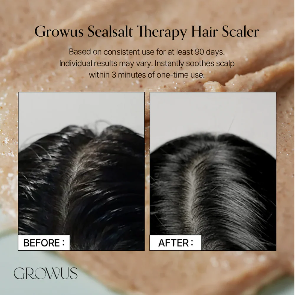 GROWUS Sea Salt Therapy Scalp Scaler 250g - Image 6