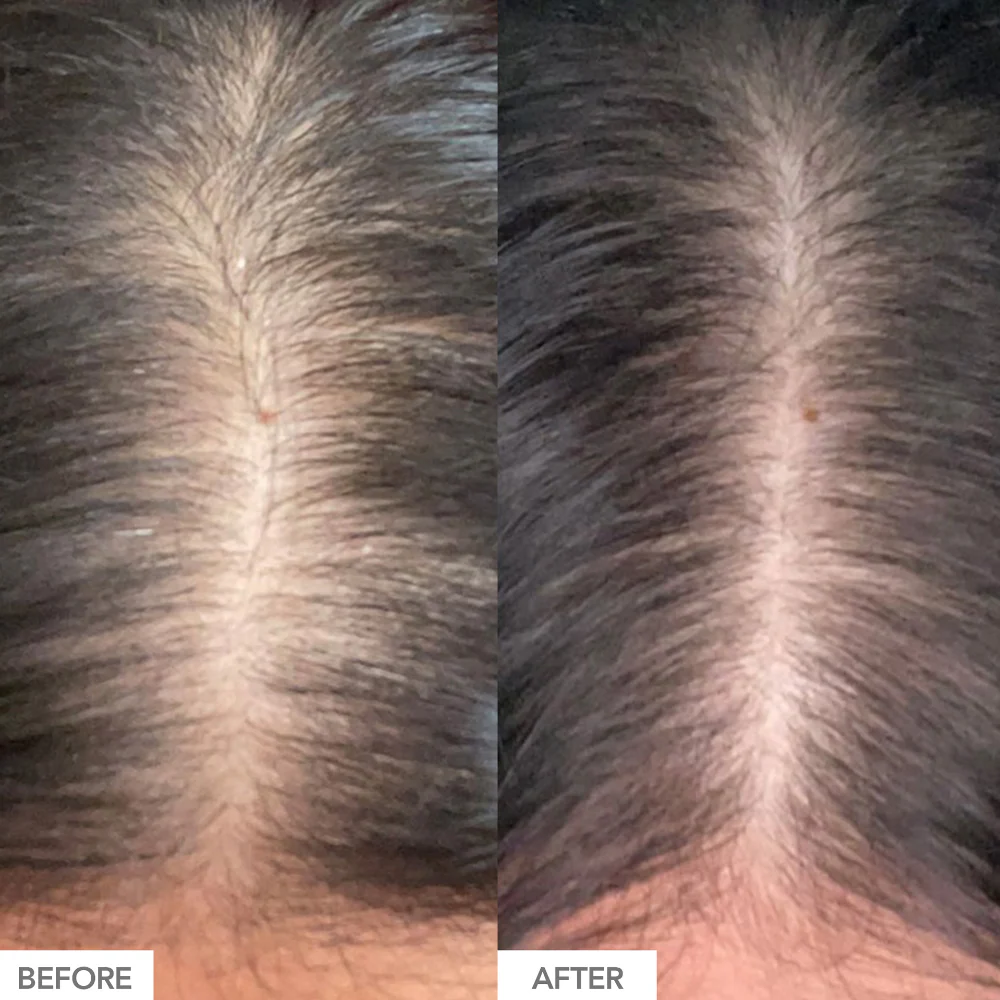 Hairtamin Advanced Formula 30 Capsules - Image 2