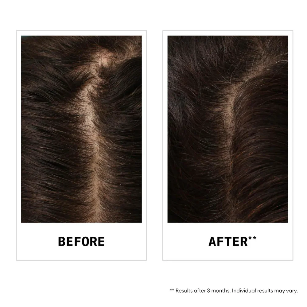 Nioxin Anti-Hair Loss Shampoo 475ml - Image 4