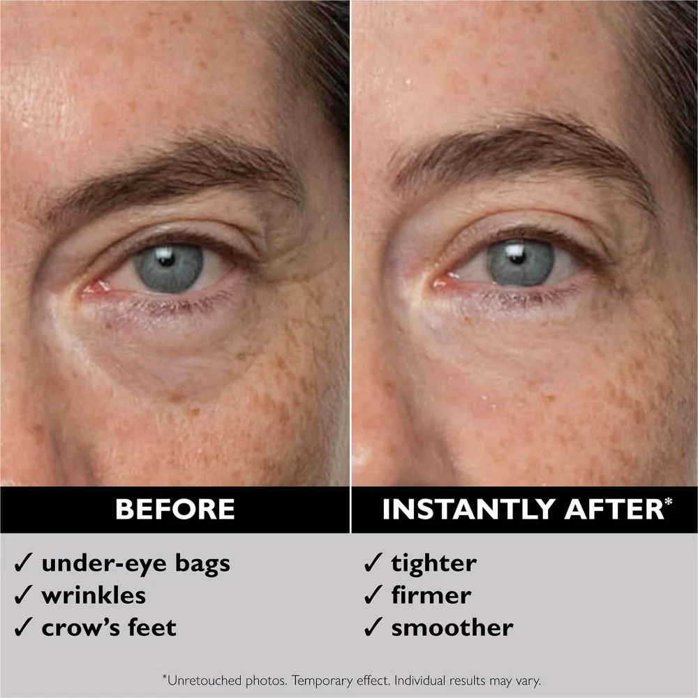 Peter Thomas Roth FIRMx Eye Duo Set - Image 3